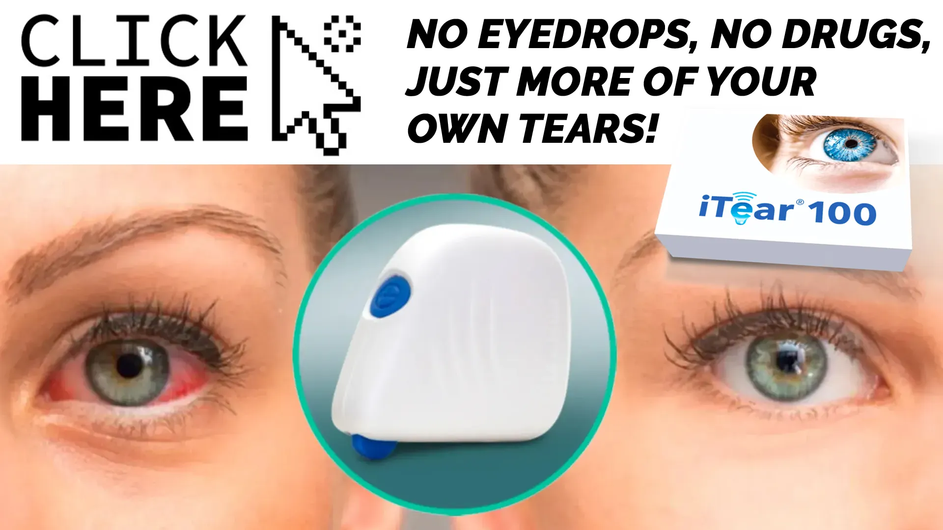 Why Choose iTear100 Over Other Dry Eye Solutions?